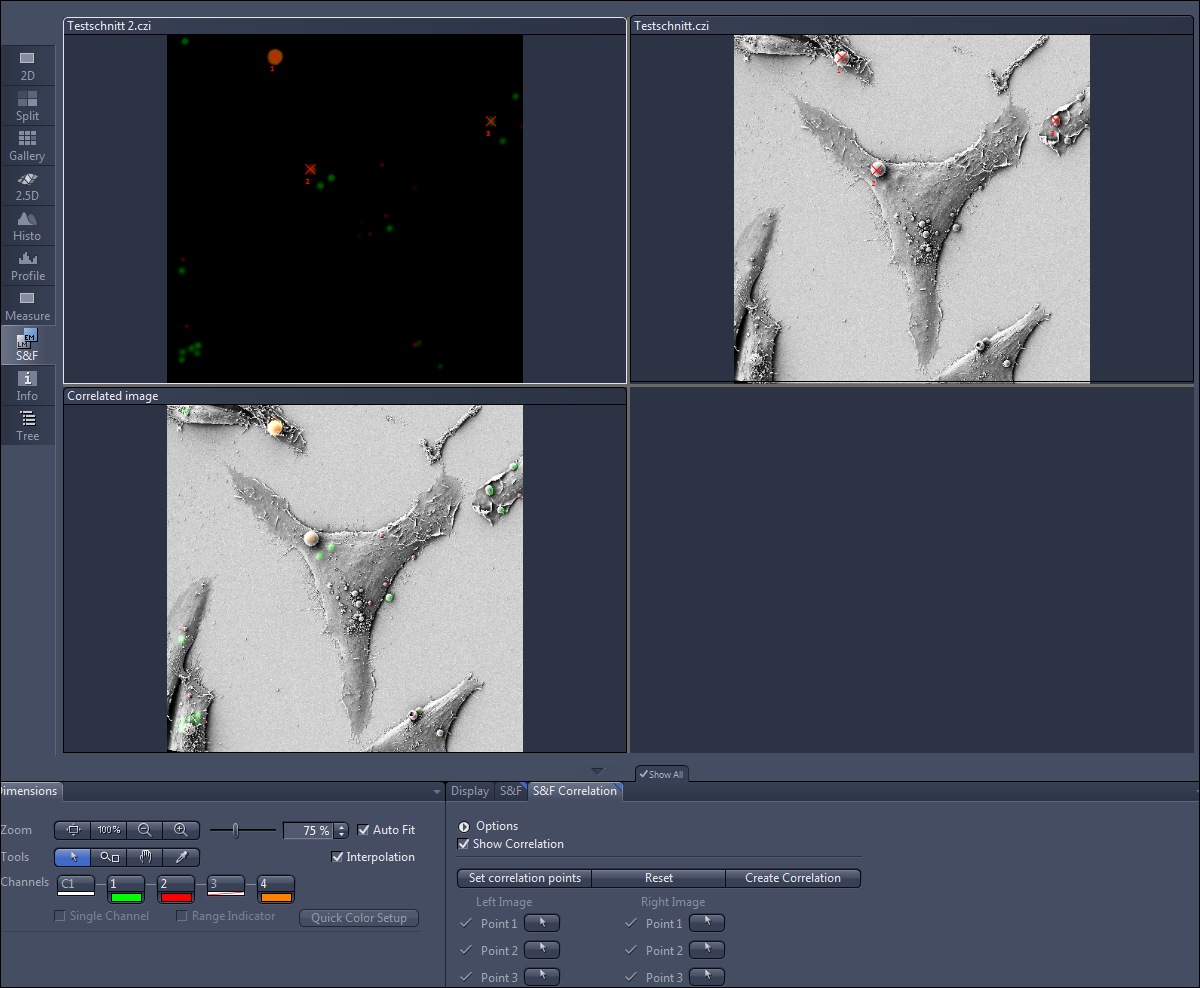 GUI with three panes Testschnitt 2.czi, Testschnitt.czi, Correlated image showing grayscale cells with colored markers