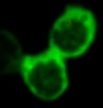 Three connected green circular blobs on black background, blurred