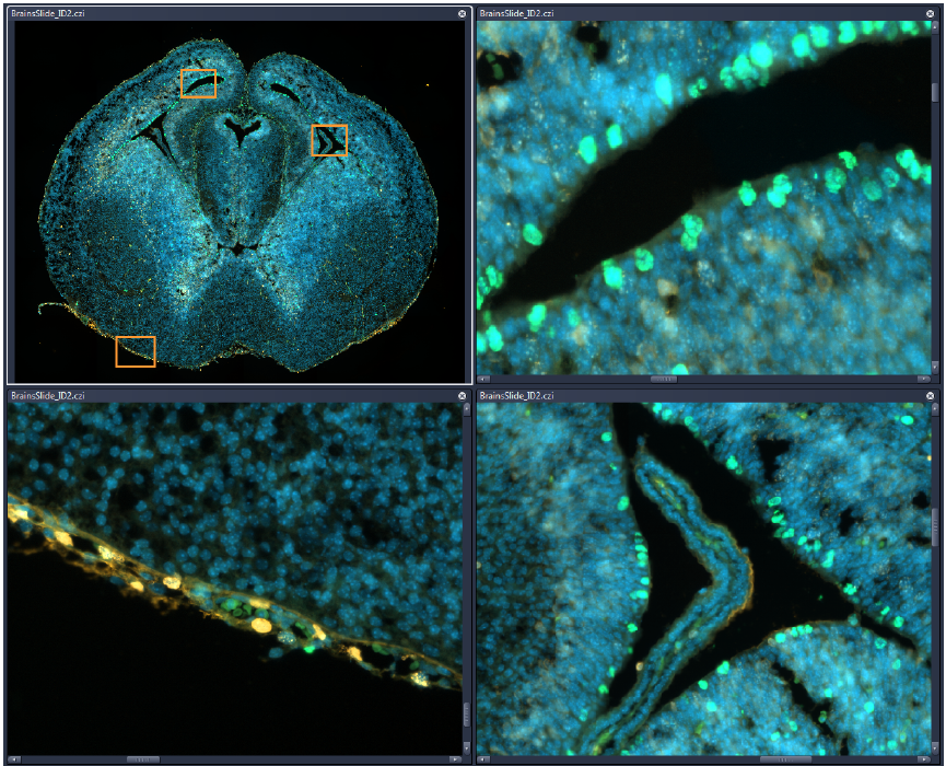 BrainsSlide_ID2.czi screenshot: cross-section overview with 3 orange boxes and 3 magnified cyan panels with green spots