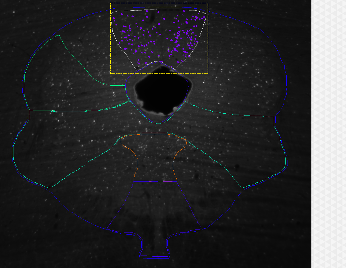 Grayscale spinal cross-section with blue outer contour, green internal boundaries, orange lower region, dashed yellow box and white outlined area with purple dots