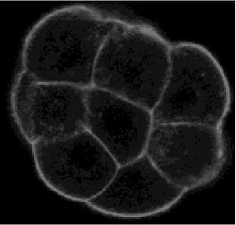 Fluorescent microscopy image showing several bright ring-like cell outlines on a black background