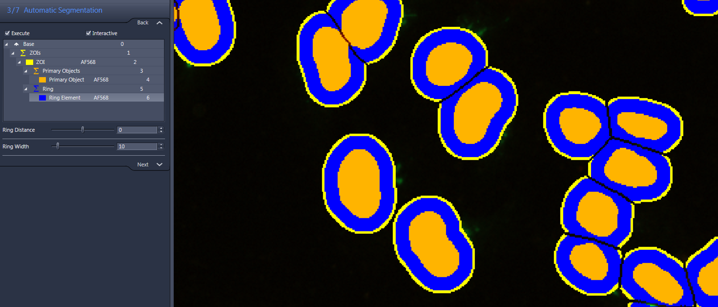 Segmentation panel '3/7 Automatic Segmentation' alongside overlaid orange objects, blue rings and yellow ZOI