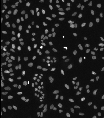 Grayscale microscopy image of many bright oval nuclei scattered on a dark background