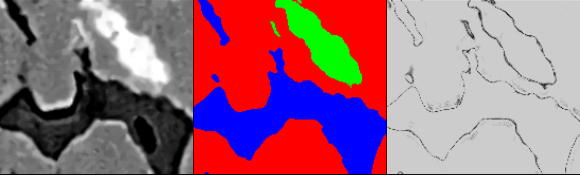 Three-panel image: left grayscale original, center segmentation in red blue green, right grayscale confidence map