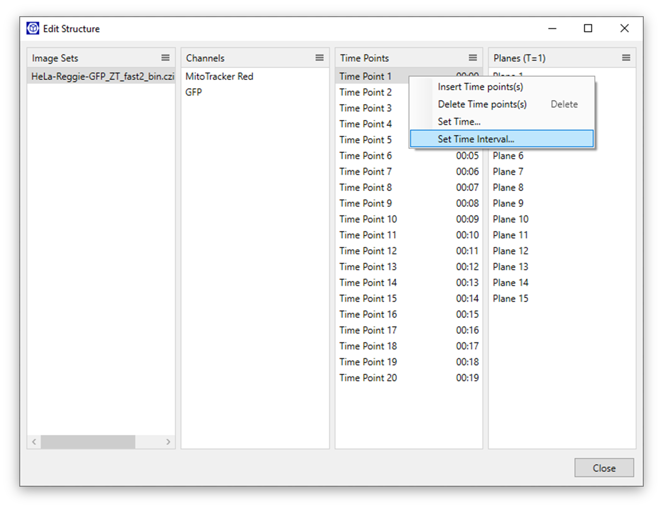 Edit Structure dialog showing Image Sets, Channels (MitoTracker Red, GFP), Time Points list and context menu with Set Time Interval highlighted