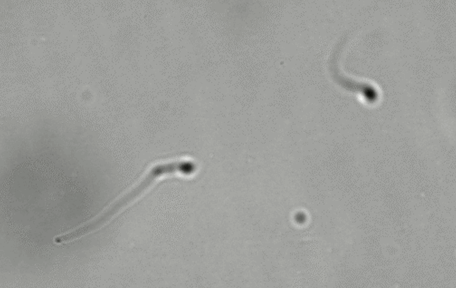 Grayscale micrograph of three curved translucent microscopic objects with dark rounded heads on a mottled gray background