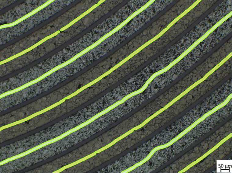 Microscope image of diagonal parallel granular bands with neon green outlines and a 50 µm scale bar