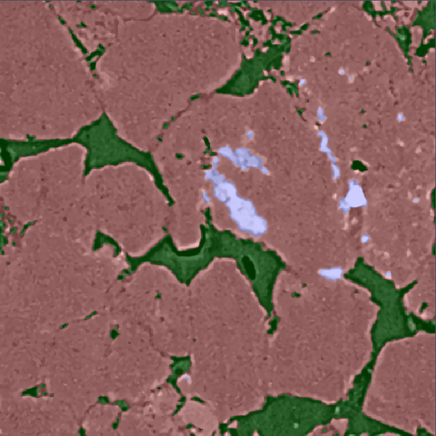 Image overlaid with translucent red-brown particle masks, green gap fills, and pale blue segmented areas