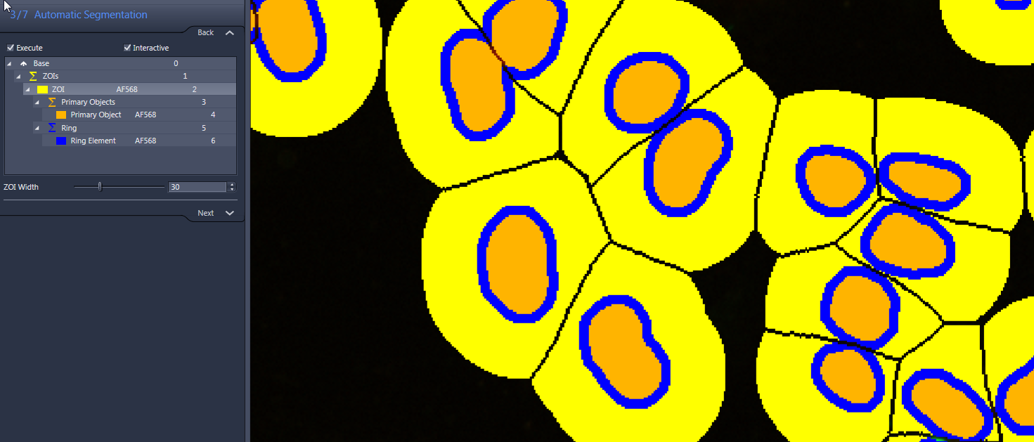 Yellow segmented cells with orange centers and blue rings on dark background, left 'Automatic Segmentation' menu