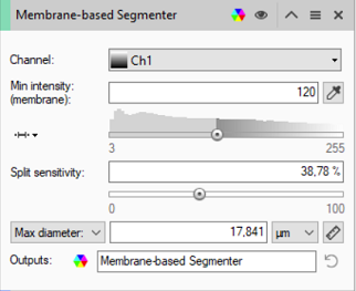 Membrane-based Segmenter UI: Channel Ch1, Min intensity (membrane) 120, Split sensitivity 38,78 %, Max diameter 17,841 µm