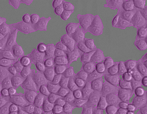 Grayscale image with purple overlay highlighting segmented cell clusters