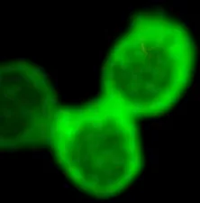 Three bright green fluorescent circular shapes with soft blurred edges on a black background