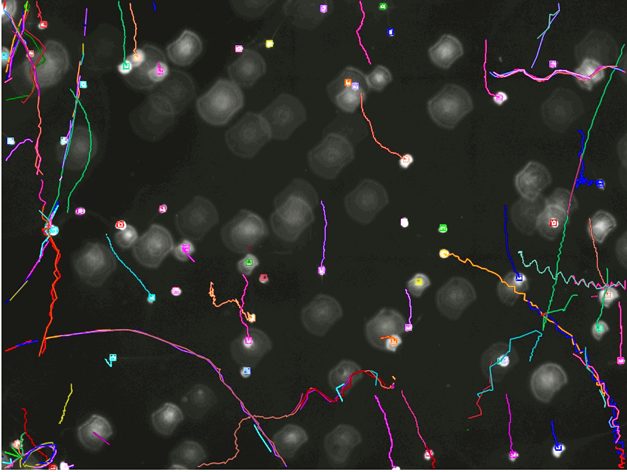 Dark microscopy image with bright circular blobs overlaid by colorful curved tracking lines