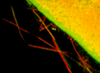 Bright red filamentous strands over a dark background adjacent to a yellow-green textured region