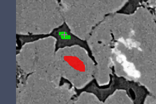 Zoomed grayscale region showing a red labeled area and a small green labeled mark