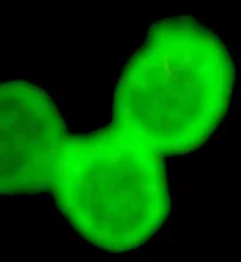 Three bright green circular blobs connected on a black background