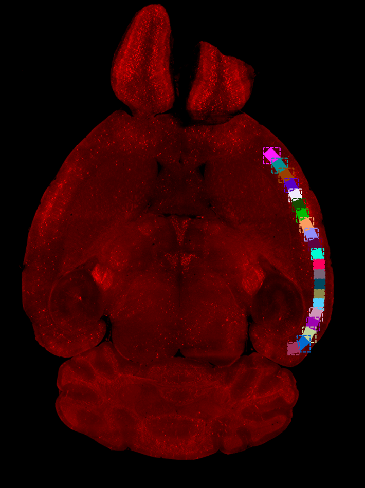 Red fluorescent brain section on black background with a vertical arc of multicolored bounding-box tiles along its right edge