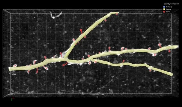 Yellow highlighted neurite over white branches with red spine markers on dark grid background