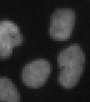 Pixelated close-up of several gray oval spots against a dark background
