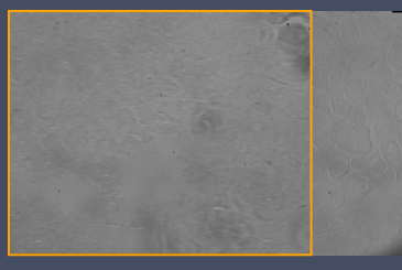 Grayscale microscope image with an orange rectangular overlay framing the left-center area