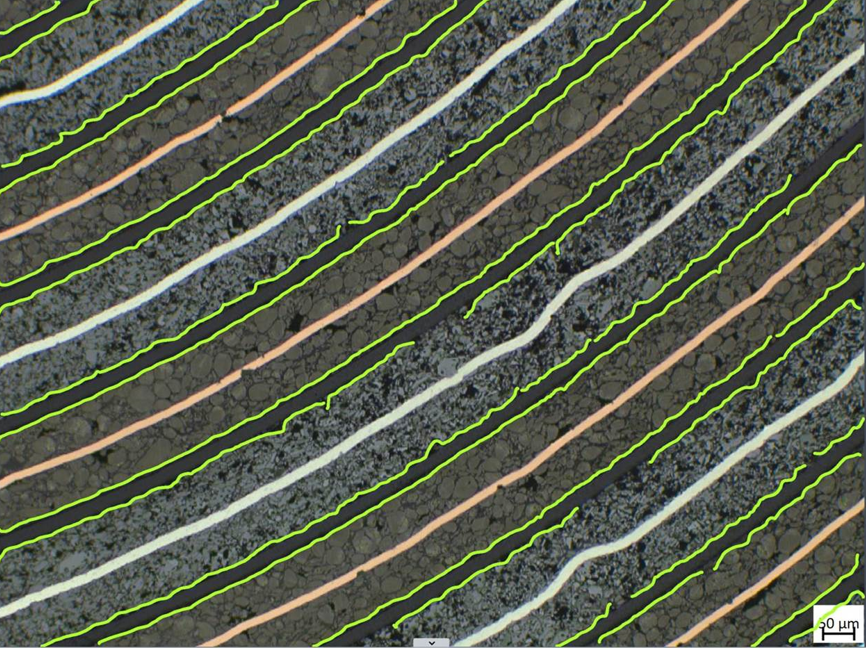 Microscope close-up of diagonal textured bands with green contour outlines and alternating pale bands, 20 µm scale bar
