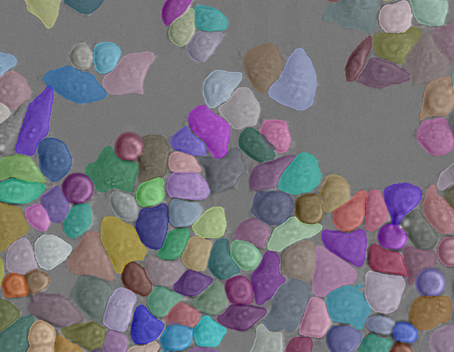 Grayscale image with multicolored overlays showing individual segmented cell instances