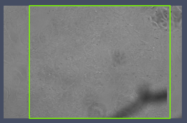 Grayscale microscope view with a green rectangular overlay framing the center and a dark curved shadow at lower right