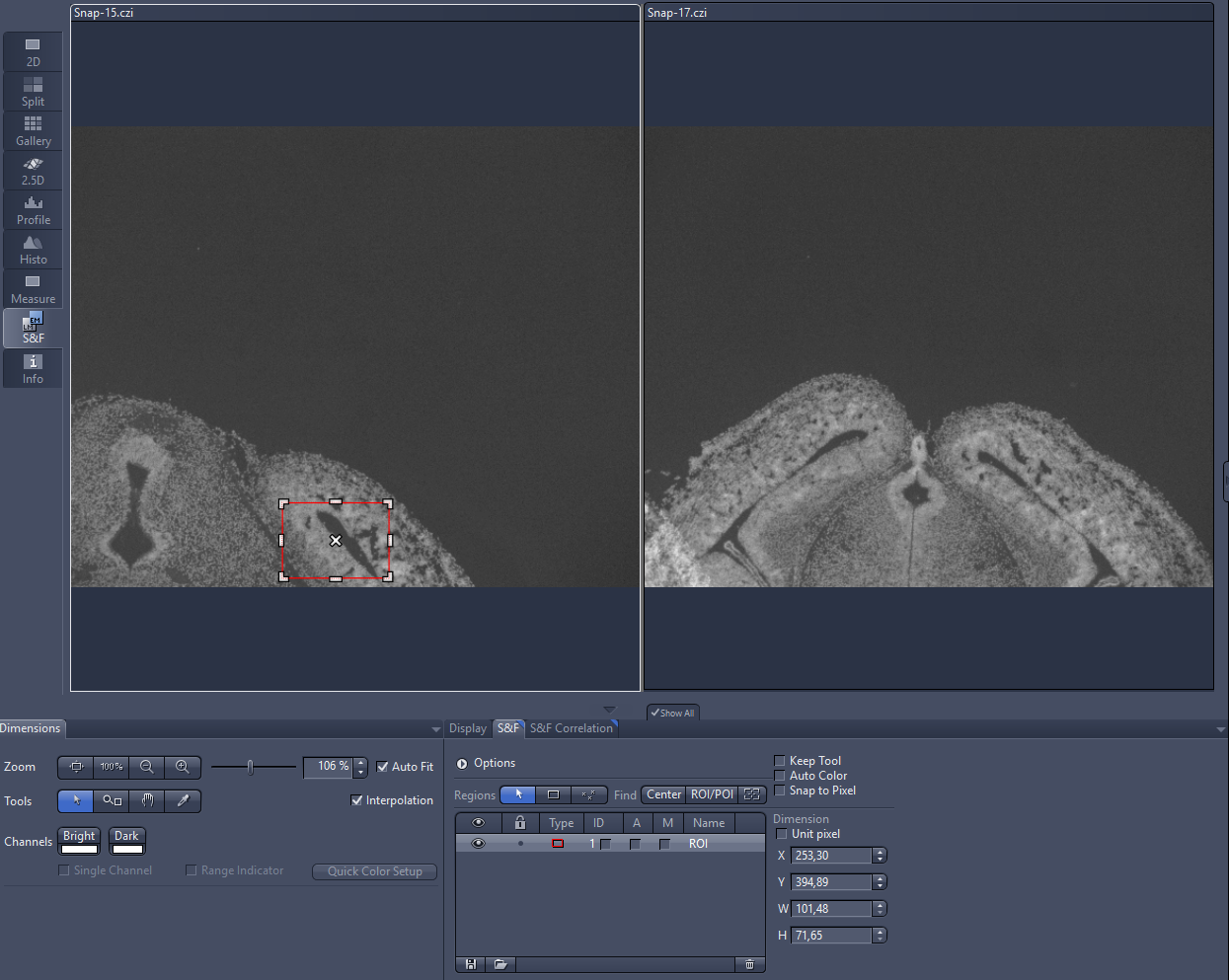 ZEN S&F split view with two images labeled Snap-15.czi and Snap-17.czi, left image shows red dashed ROI box.