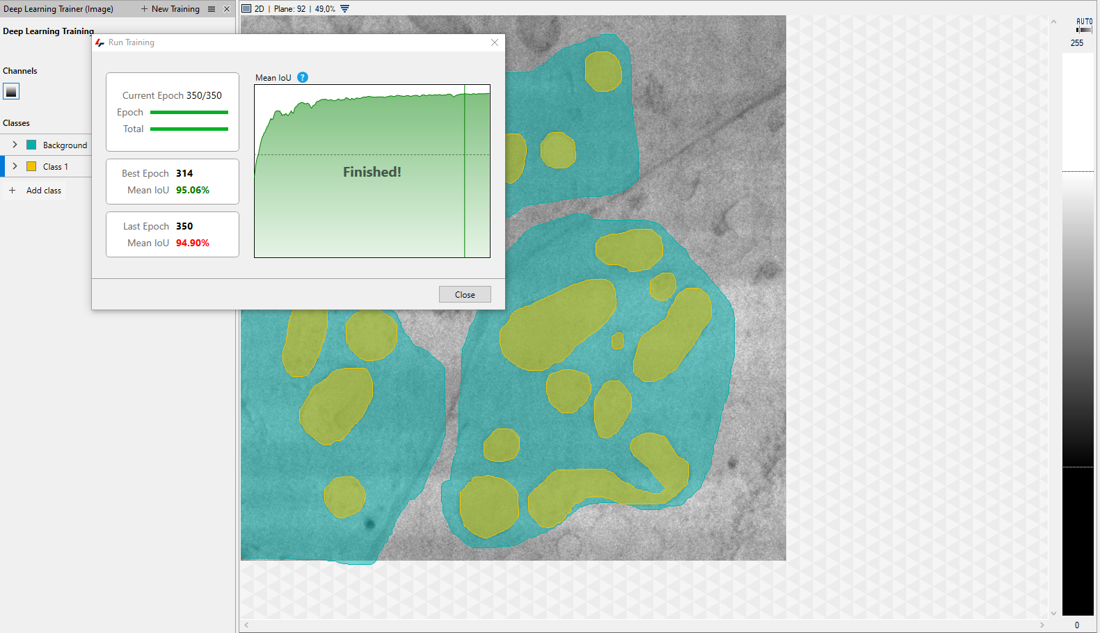 Segmentation screenshot: teal regions with yellow spots on grayscale image and 'Finished!' dialog showing epoch and Mean IoU