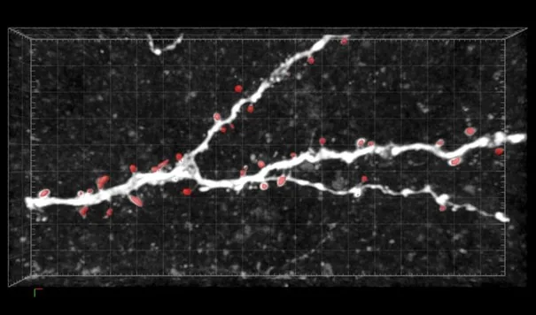 White neurite branches on a dark grid background with red marked spine segments along the branches