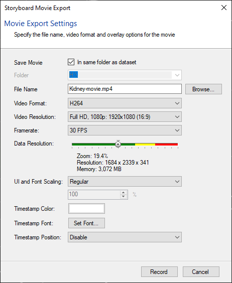 Dialog titled Storyboard Movie Export showing Movie Export Settings with file Kidney-movie.mp4, H264, Full HD 1080p, 30 FPS
