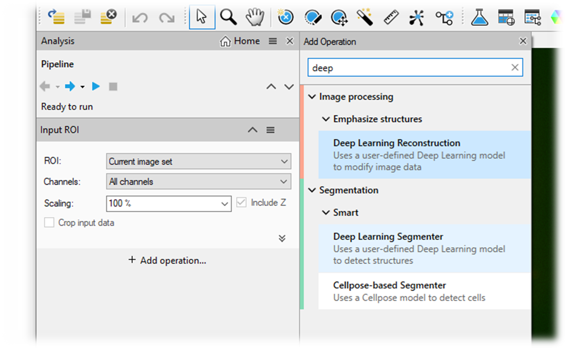 App UI shows Analysis panel and Add Operation search for deep with Deep Learning Reconstruction and Segmenter