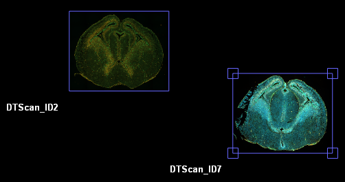 Two colored brain slice images labeled DTScan_ID2 (left) and DTScan_ID7 (right) on black background