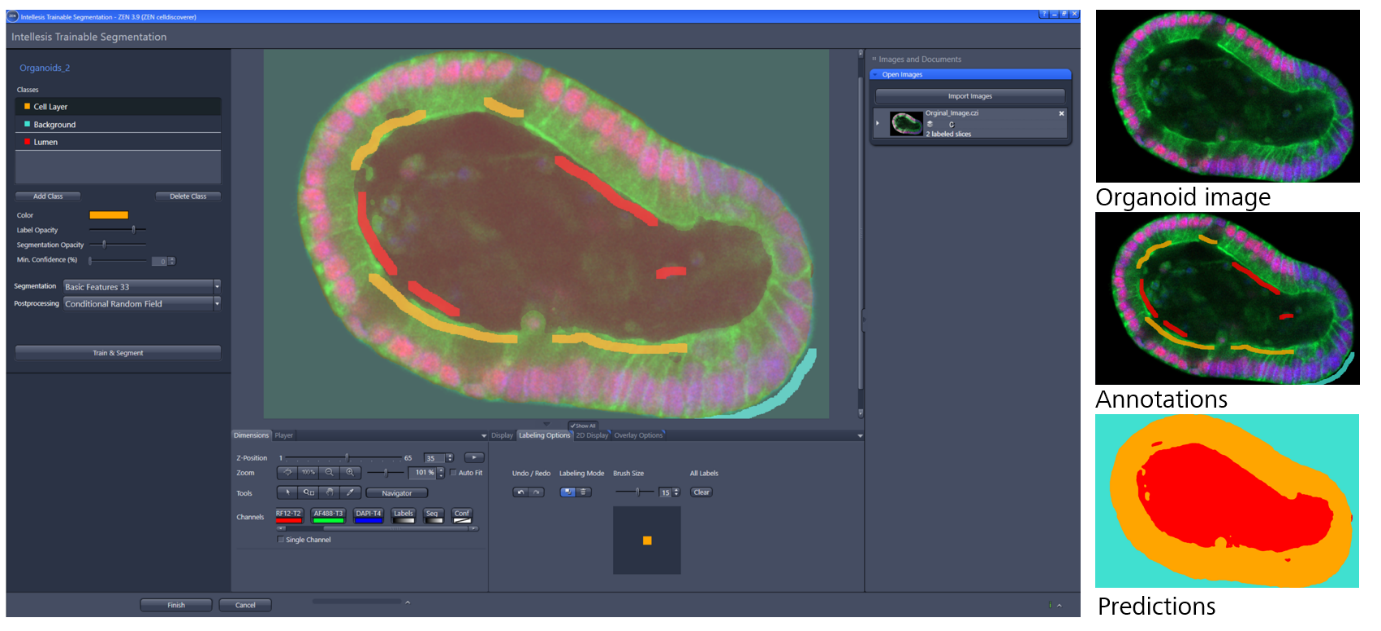 Intellesis Training UI in ZEN