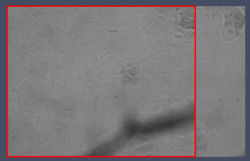 Grayscale microscope view with a red rectangular overlay and a dark diagonal shadow crossing the lower area