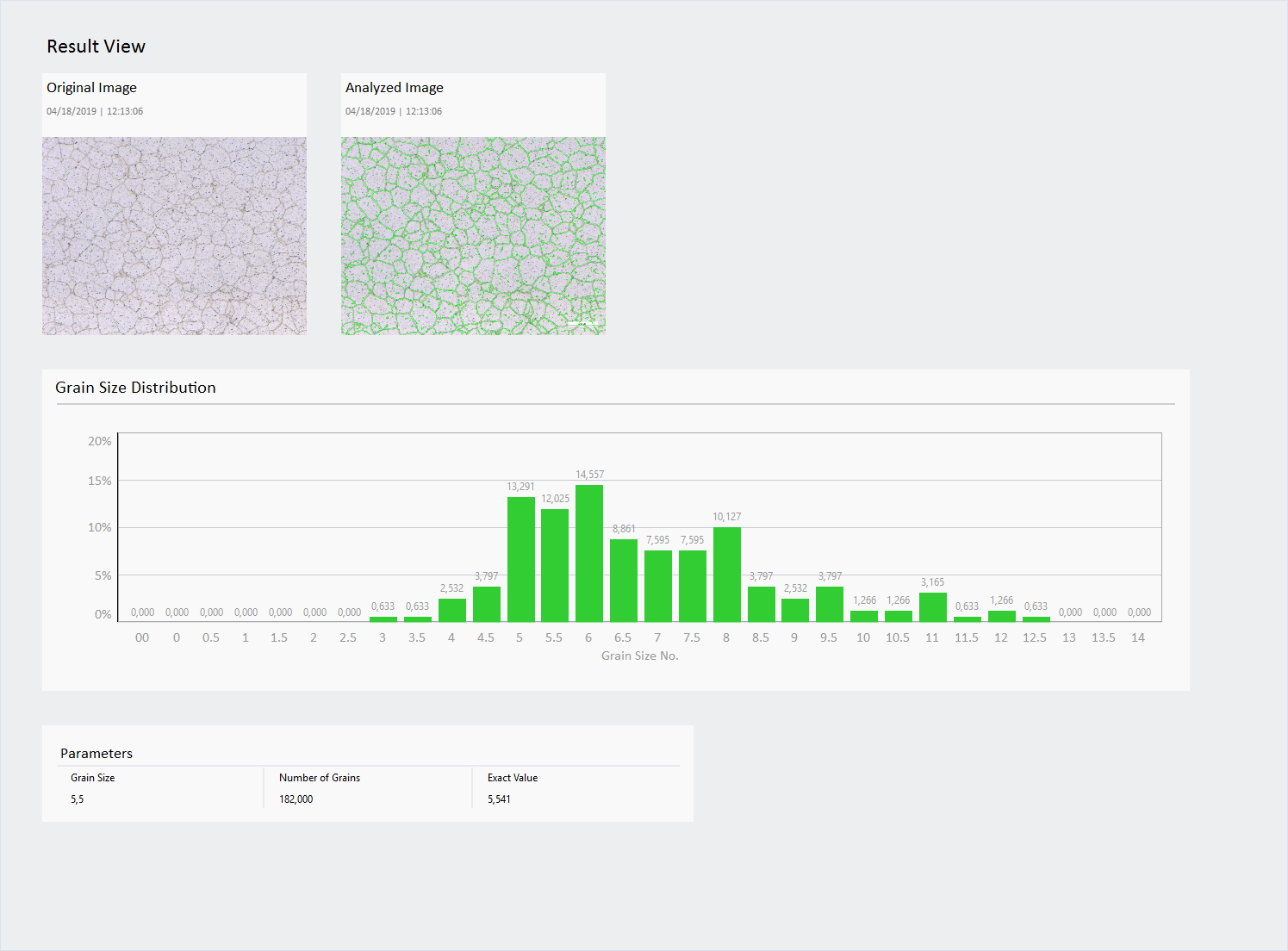 Result View: Original Image and Analyzed Image with green boundaries, grain size distribution chart and parameters table.