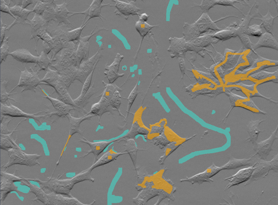 Grayscale microscopy image with turquoise and orange segmentation overlays on cell structures