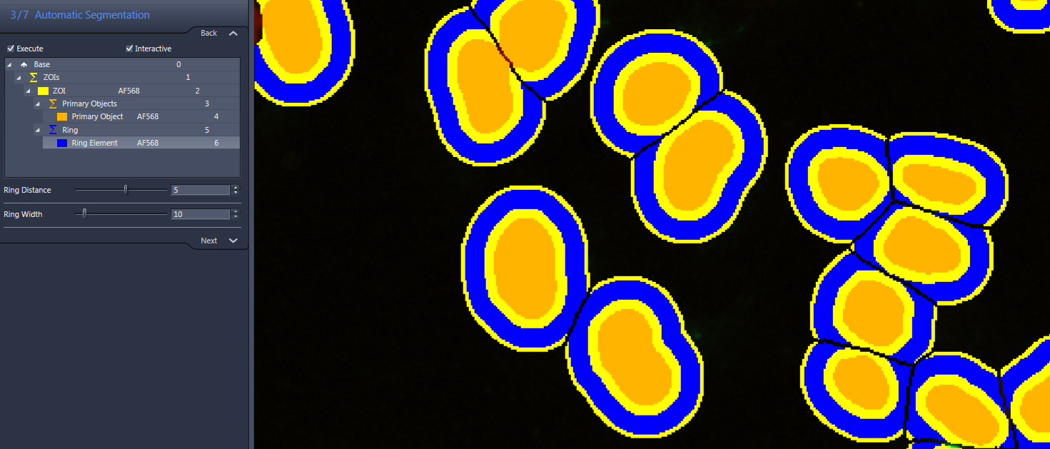 Microscopy view of segmented cells with orange centers and blue/yellow rings, left panel reads 3/7 Automatic Segmentation