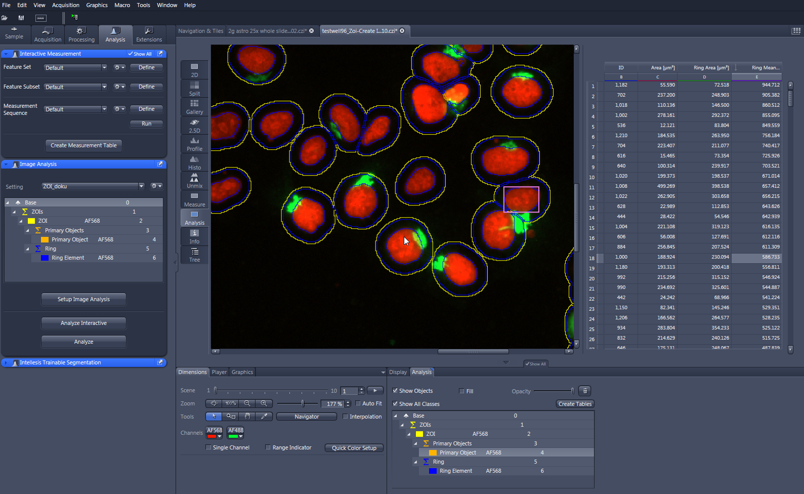 Microscopy image of red cells with green signals and colored outlines in analysis software with measurement table