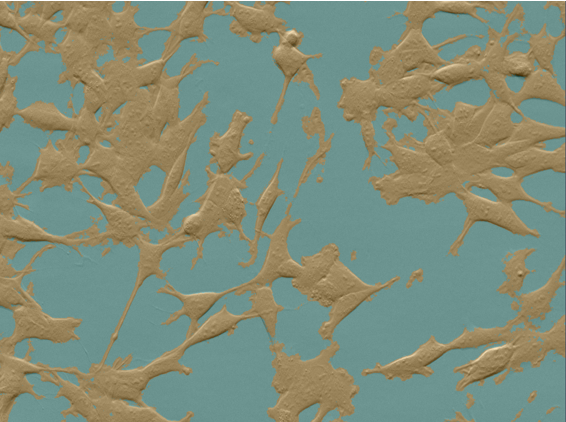 Tan-colored cells on a teal background in a microscopy image