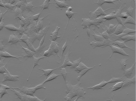 Grayscale microscopy image of elongated flattened shapes with thin connecting processes across the frame