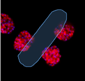 Black background with clustered red circular spots and a large translucent blue elongated shape outlined in cyan