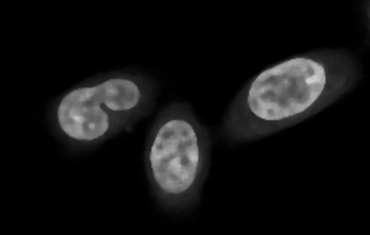 Three cell nuclei as bright gray ovals on a black background