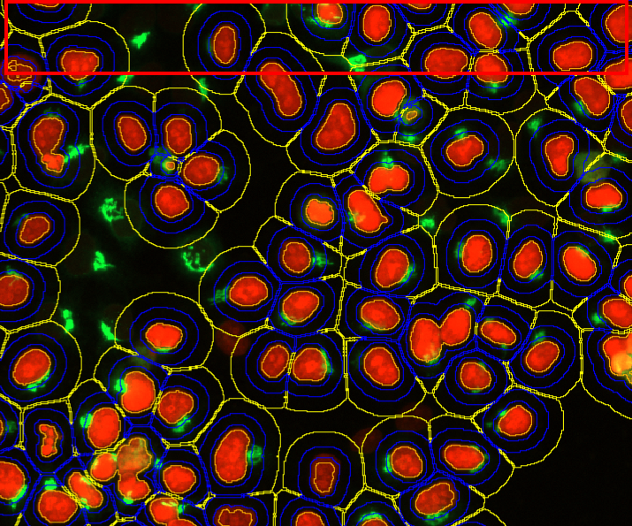 Cluster of red oval shapes with blue and yellow concentric outlines and scattered green specks on a black background