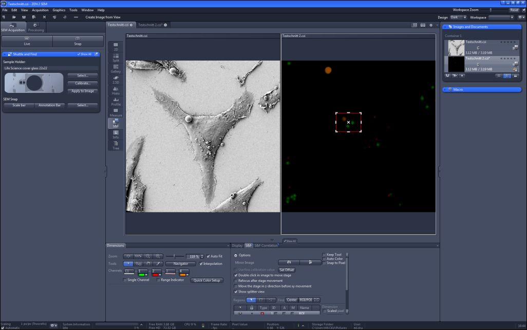 ZEN SEM workspace split view: left grayscale SEM cell image, right dark view with colored spots and dashed red selection box with white X